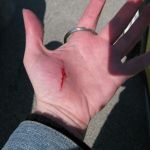 The reason I didn't get a lot of great photos. I got a deep gash from closing the open-windowed door right before going on the track. The reason I didn't get a lot of great photos. I got a deep gash from closing the open-windowed door right before going on the track.